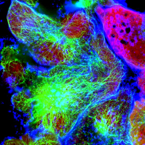 Immunofluorescent assay