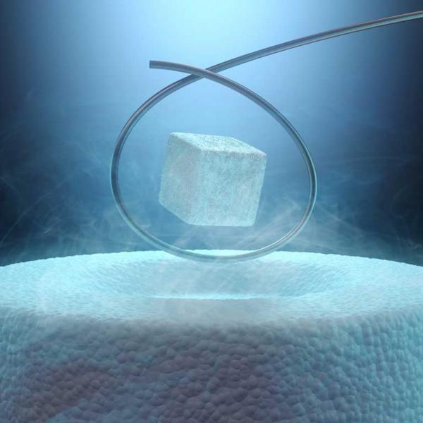 Superconductivity