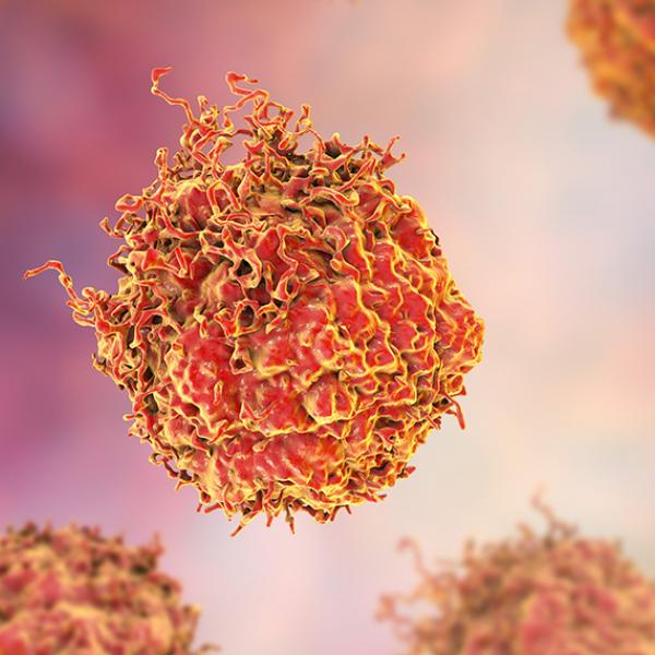 prostate cancer cells