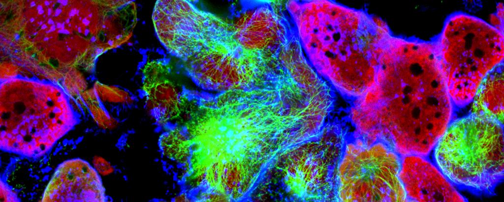 Immunofluorescent assay